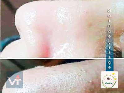 Esthétique & Cosmétique | Bio Zahra
